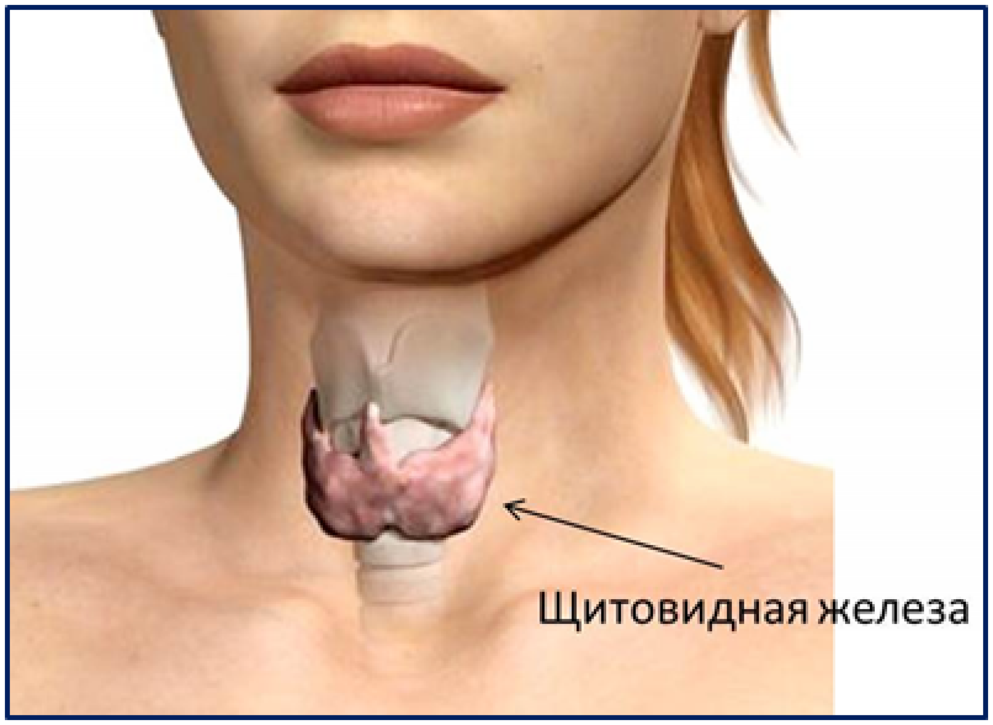 Что такое щитовидка у женщин фото